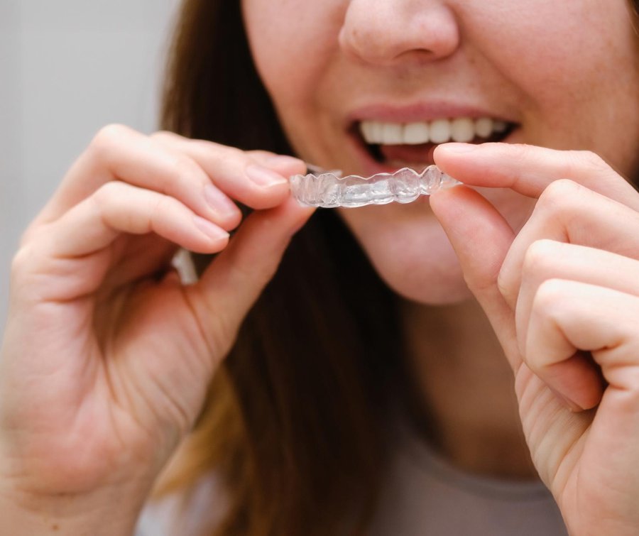 αόρατη ορθοδοντική Θεσσαλονίκη διαφανείς νάρθηκες